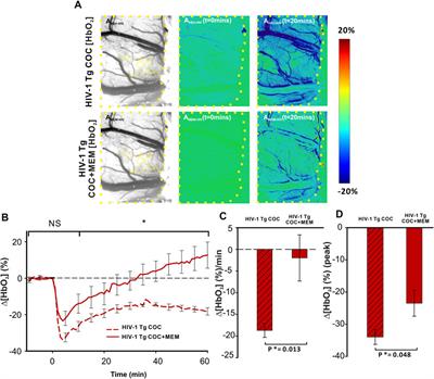 Memantine Attenuates Cocaine and neuroHIV Neurotoxicity in the Medial Prefrontal Cortex